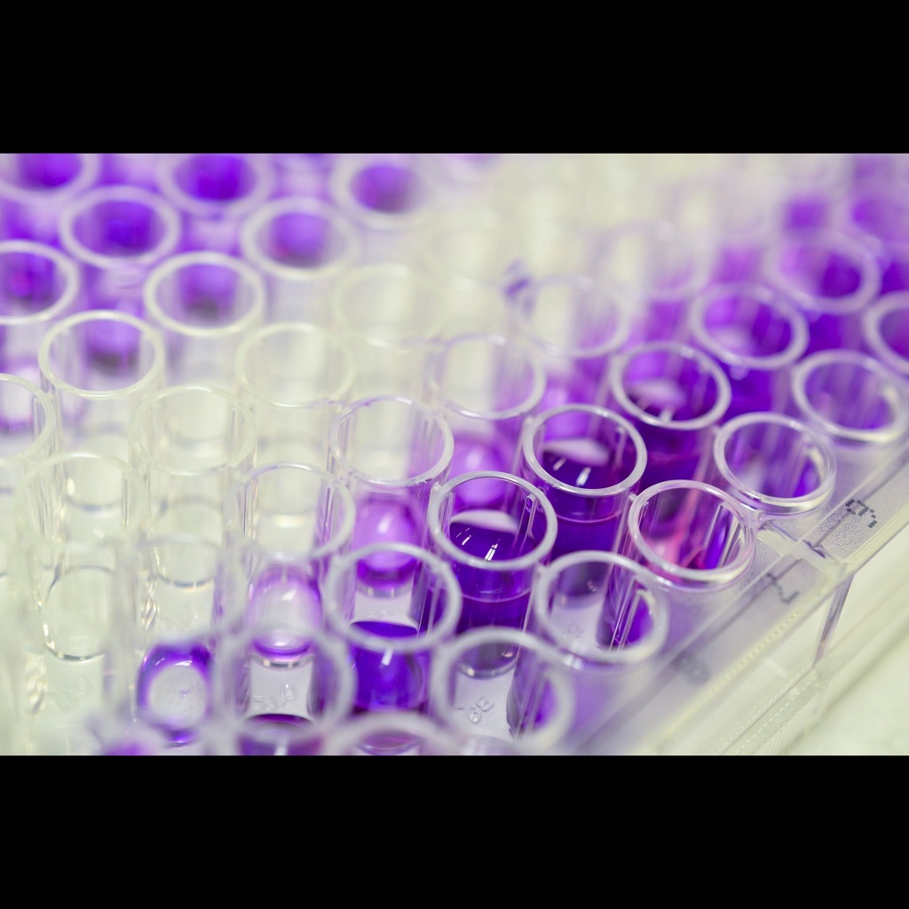 Human Cyclooxygenase 1 ''COX1'' ELISA Assay   96 wells plate